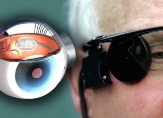 Inventia care reda vederea orbilor – ochiul bionic