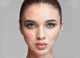 4 cauze mai putin evidente ale cosurilor corporale care nu sunt legate de hormoni