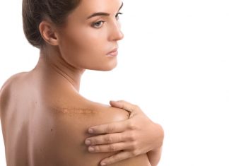 Cum sa ascunzi cicatricile: 5 sfaturi si remedii care te ajuta