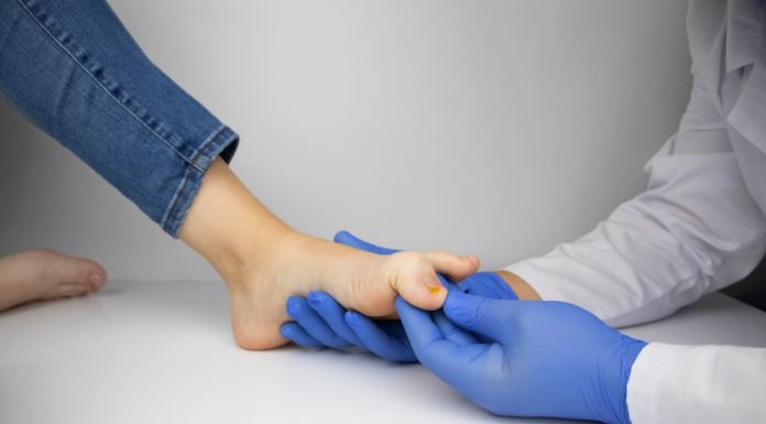 Onicomicoza – cum recunoști ciuperca unghiei și cum o tratezi corect